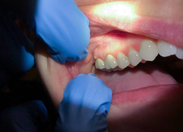 Best Weekend Emergency Dentist in Greentree, NJ